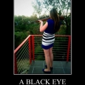 A Black Eye On Its Way2