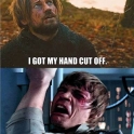 I got my hand cut off....