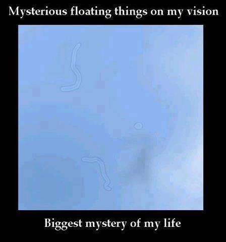 Mysterious Floating Things On My Vision