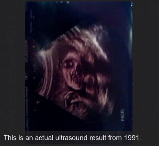 A scary ultrasound
