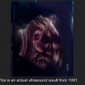 A scary ultrasound