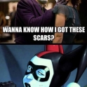 how i got the scars