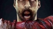 Suarez Zombie