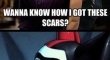 how i got the scars